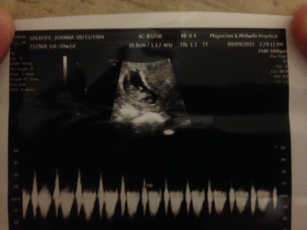 My prospective grandchild; first trimester; 2015