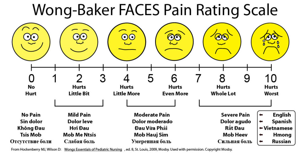 Frequently used scale for measuring pain.